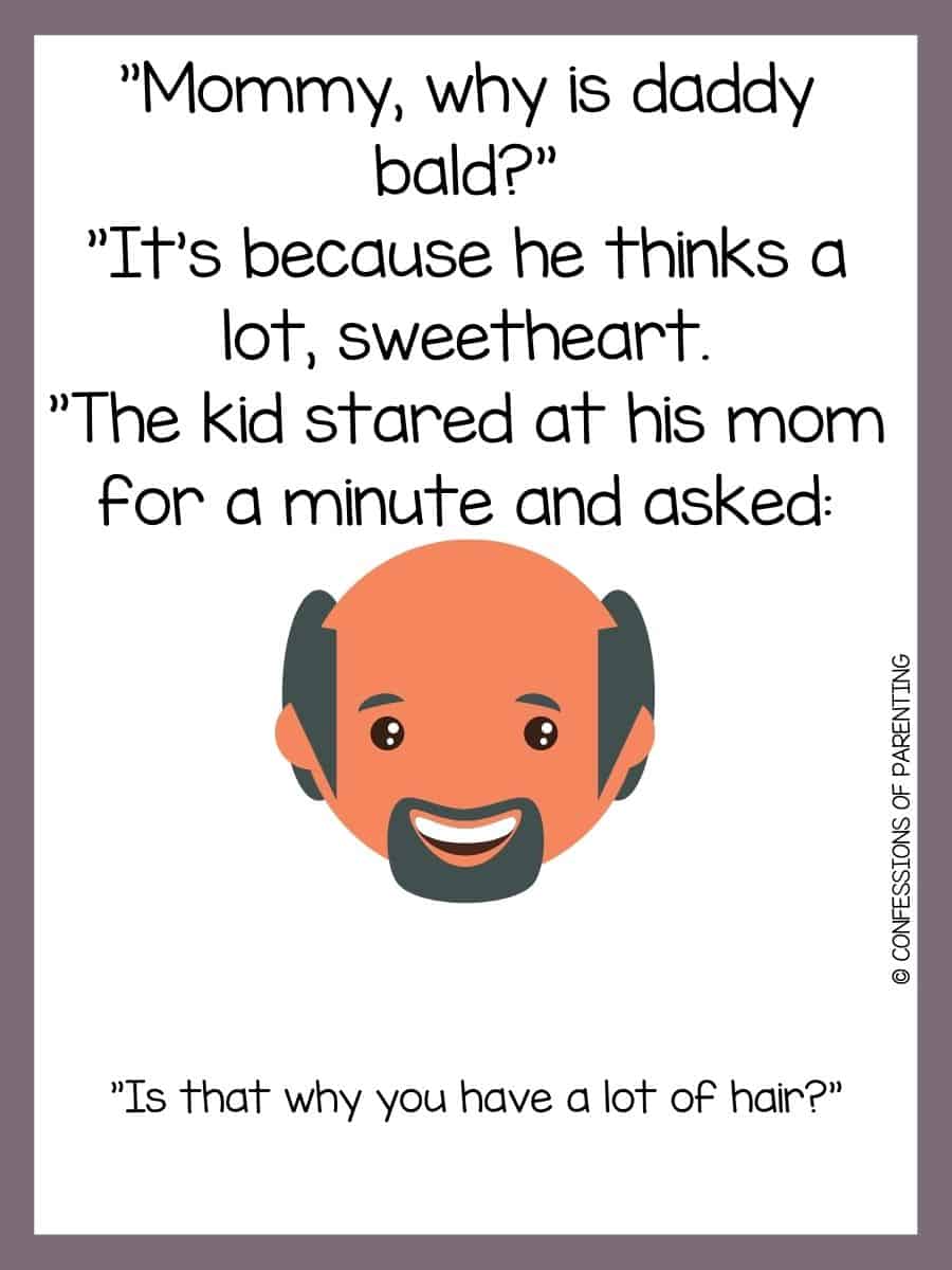 100 Best Bald Jokes [Free Joke Cards]